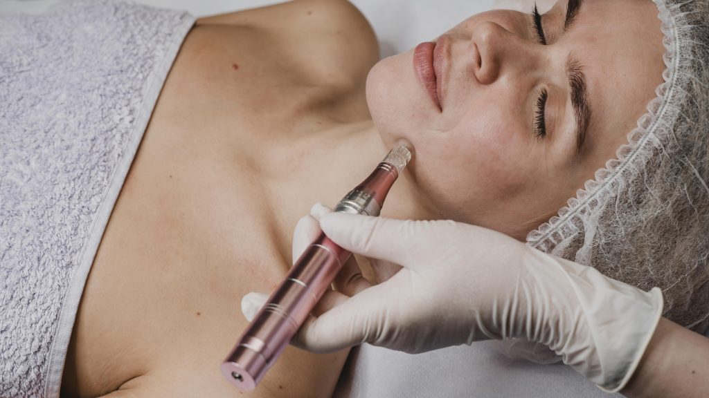 Microneedle-mesotherapy-dermapen-zdjecie-profiowe