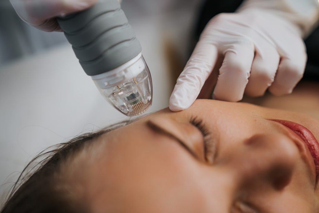 Microneedle,Rf,Lifting,Procedure.,Hardware,Cosmetology.,High,Quality,Photo